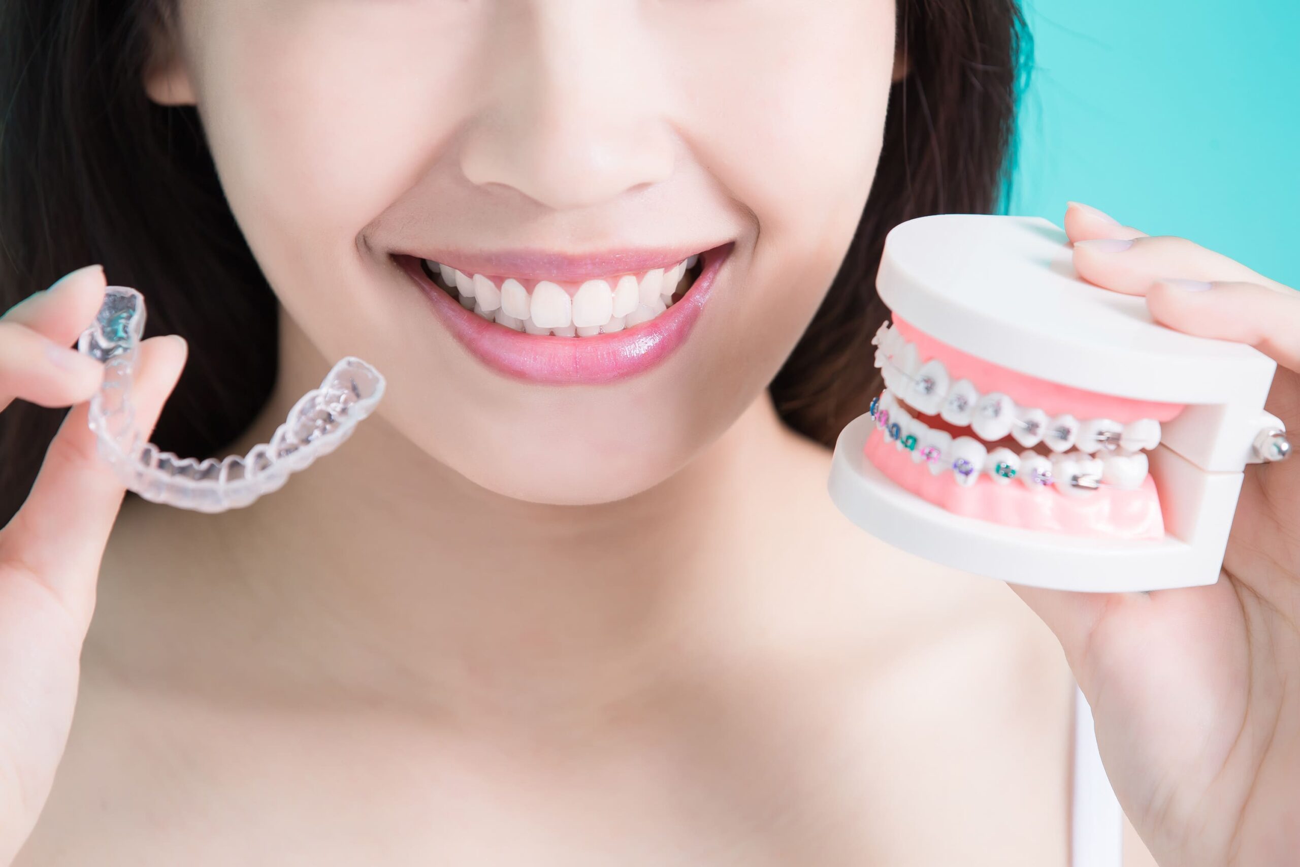Clear Ceramic Braces vs. Invisalign: Which Is Right for You? - Westwalk
